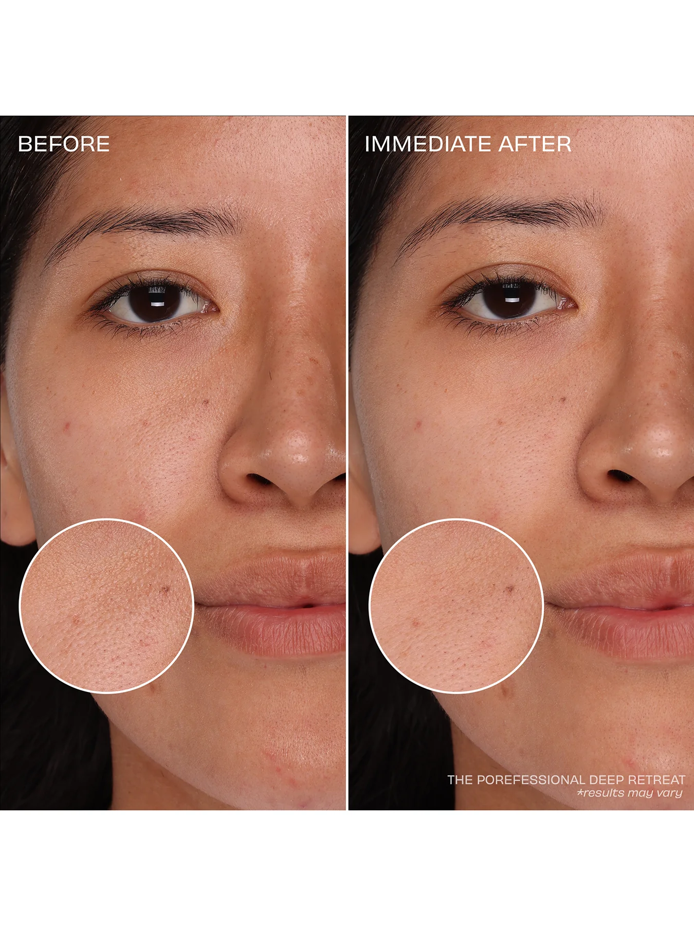 Pore Care Trial Set for Clear and Refined Skin - Image 3