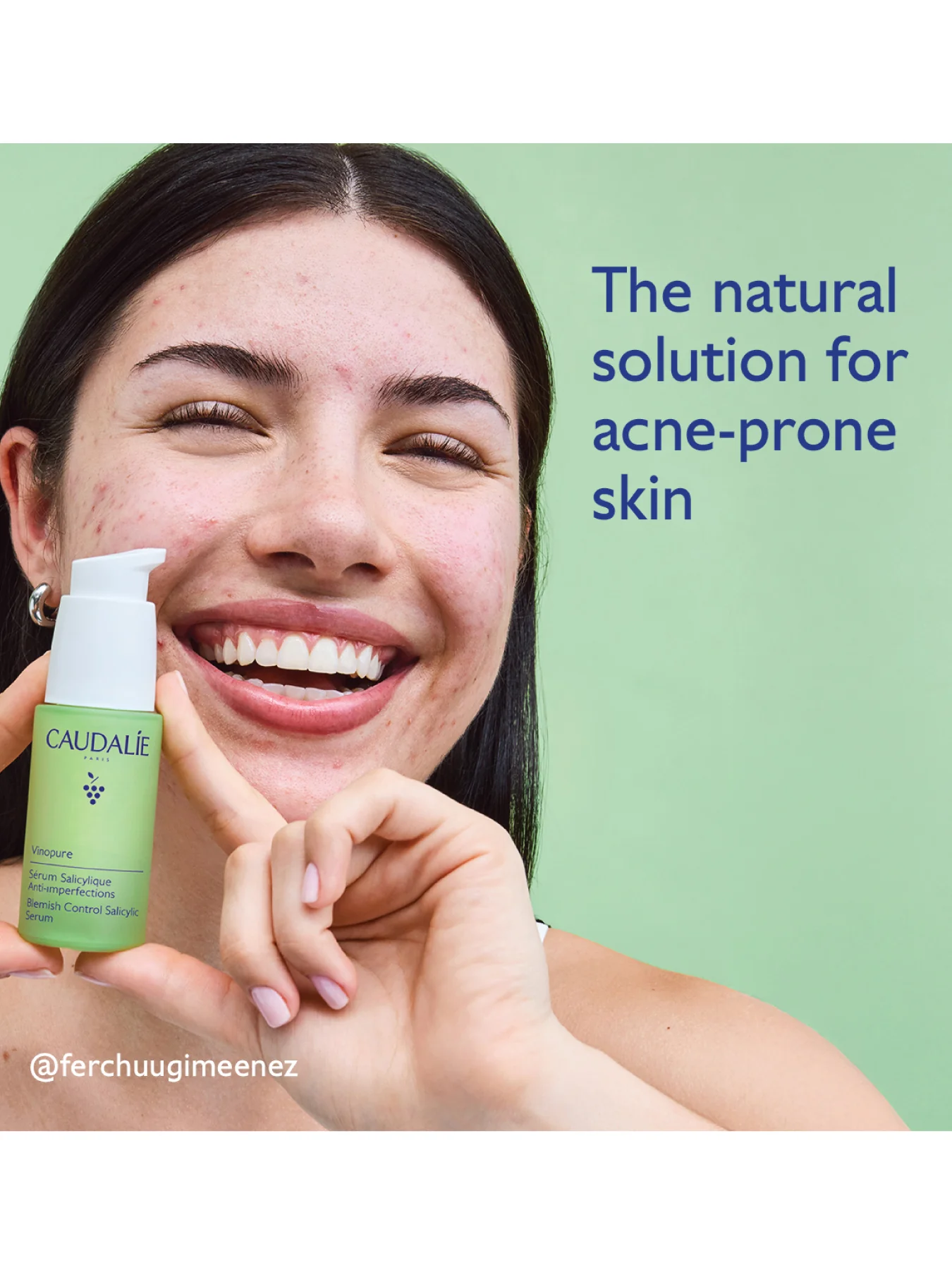 Vinopure Blemish Control Salicylic Serum 30ml - Image 2