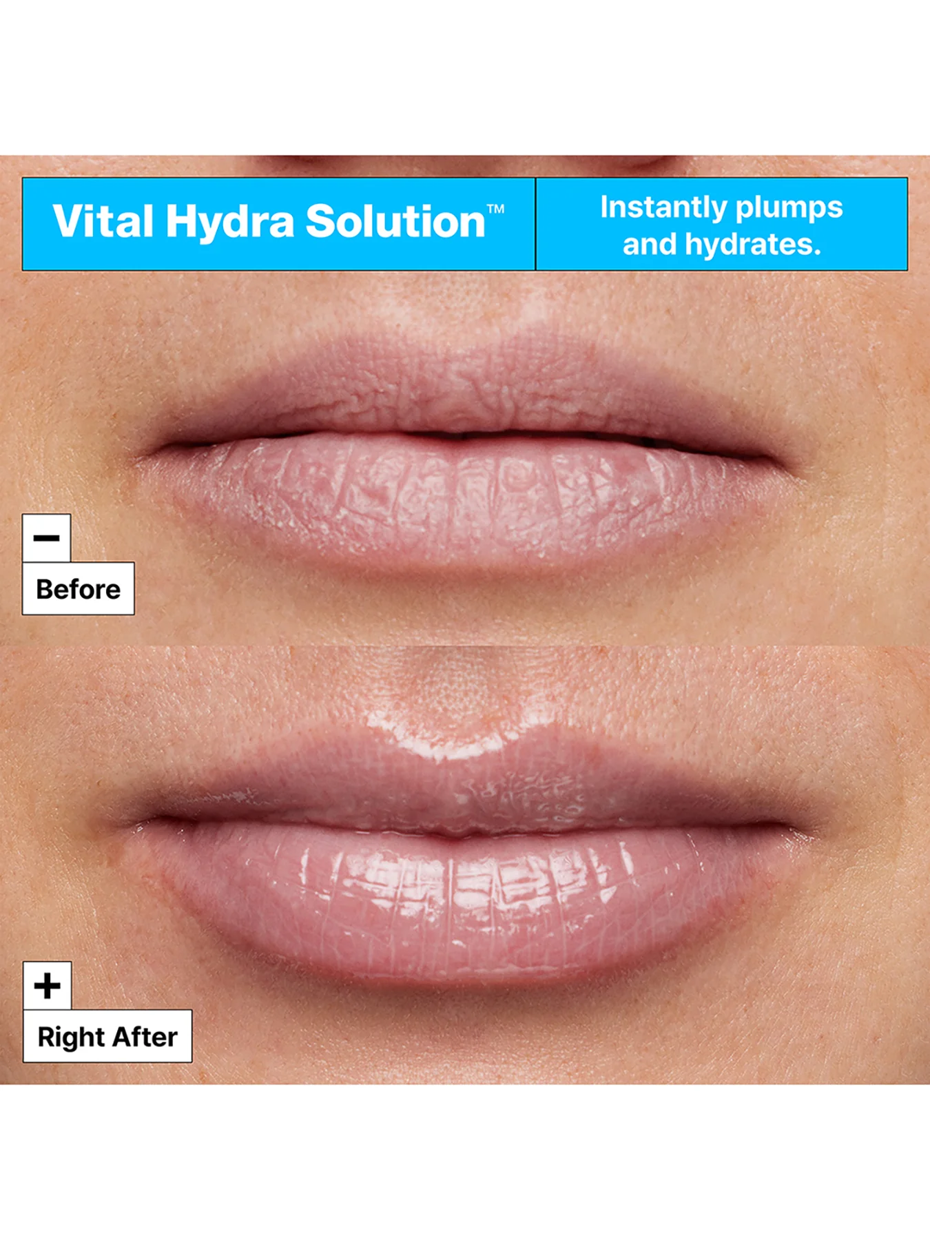Vital Hydra Solution Lip Mask 20 ml - Image 4