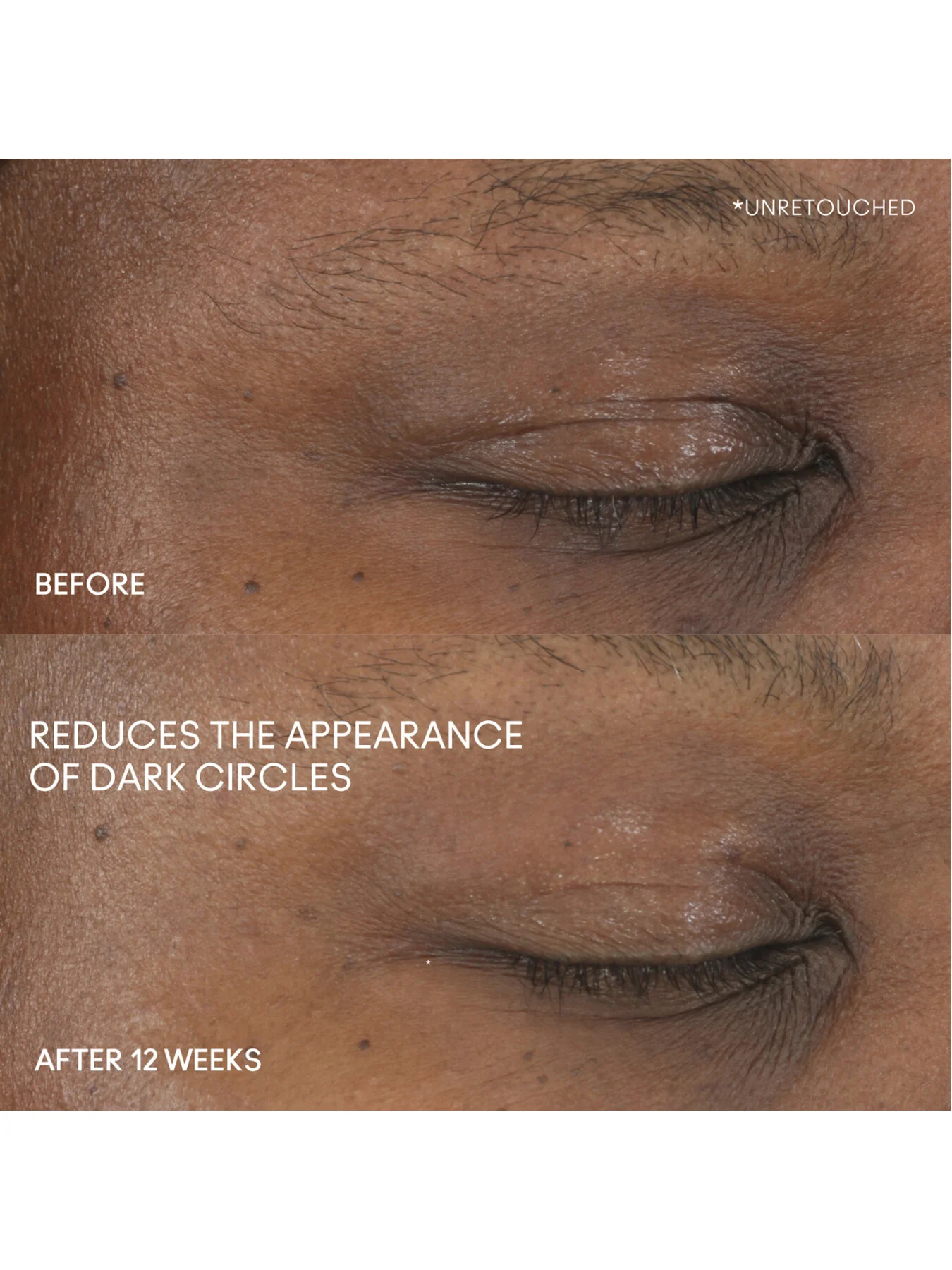 Hyper Real Serumizer Eye - Image 5
