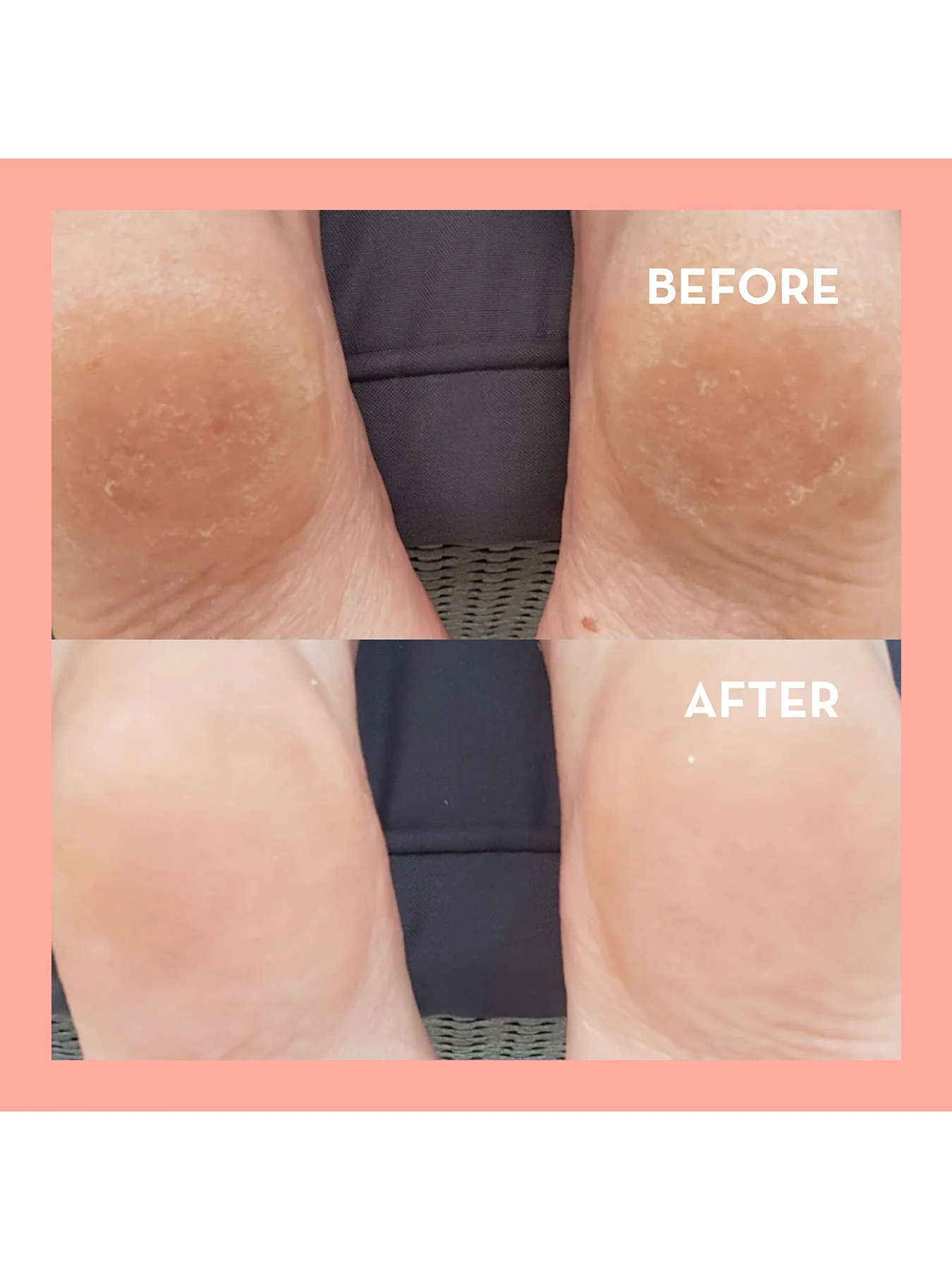 Rosy Toes Instant Pedicure - Image 3